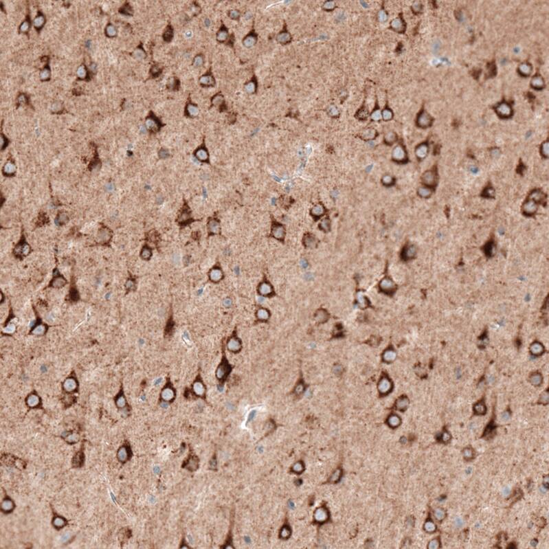 Sortilin Antibody (CL6528) - Azide and BSA Free Immunohistochemistry-Paraffin: Sortilin Antibody [NBP3-44415]