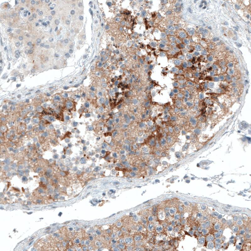 Sortilin Antibody (CL6528) - Azide and BSA Free Immunohistochemistry-Paraffin: Sortilin Antibody [NBP3-44415]
