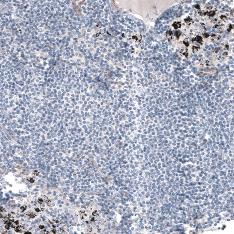 Laminin alpha 5 Antibody (CL3118) - Azide and BSA Free Immunohistochemistry-Paraffin: Laminin alpha 5 Antibody [NBP3-44417]