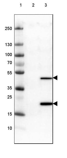 ASRGL1 Antibody (CL1679) - Azide and BSA Free Western Blot: ASRGL1 Antibody [NBP3-44418]