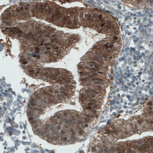 ASRGL1 Antibody (CL1679) - Azide and BSA Free Immunohistochemistry-Paraffin: ASRGL1 Antibody [NBP3-44418]