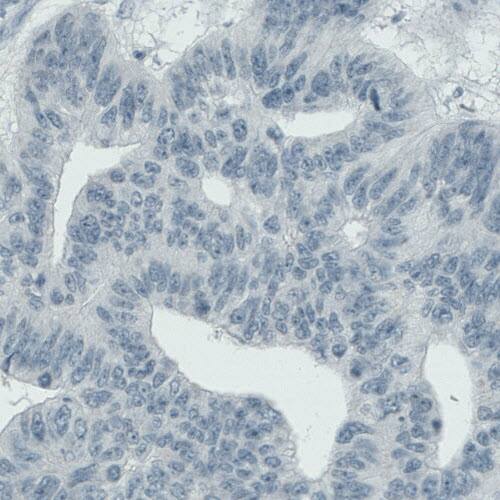 ASRGL1 Antibody (CL1679) - Azide and BSA Free Immunohistochemistry-Paraffin: ASRGL1 Antibody [NBP3-44418]