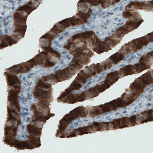 ASRGL1 Antibody (CL1679) - Azide and BSA Free Immunohistochemistry-Paraffin: ASRGL1 Antibody [NBP3-44418]
