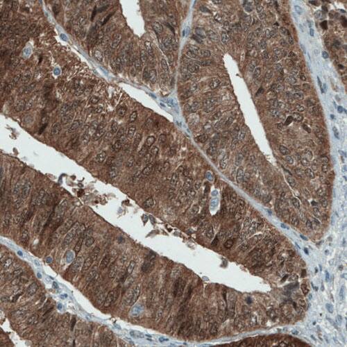 ASRGL1 Antibody (CL1679) - Azide and BSA Free Immunohistochemistry-Paraffin: ASRGL1 Antibody [NBP3-44418]