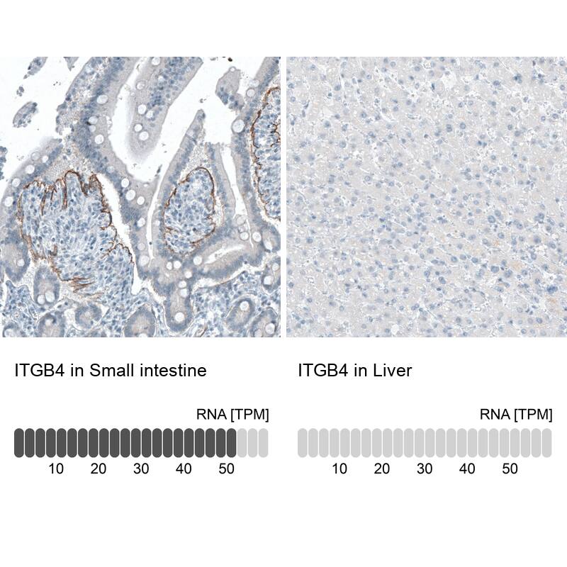 Integrin beta 4/CD104 Antibody (CL6972) - Azide and BSA Free Immunohistochemistry-Paraffin: Integrin beta 4/CD104 Antibody [NBP3-44419]