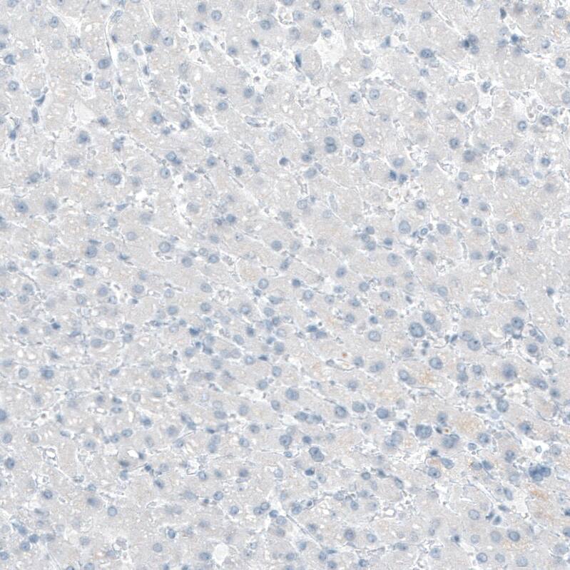 Integrin beta 4/CD104 Antibody (CL6972) - Azide and BSA Free Immunohistochemistry-Paraffin: Integrin beta 4/CD104 Antibody [NBP3-44419]