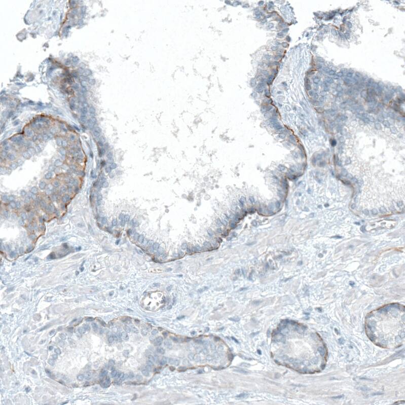 Integrin beta 4/CD104 Antibody (CL6972) - Azide and BSA Free Immunohistochemistry-Paraffin: Integrin beta 4/CD104 Antibody [NBP3-44419]