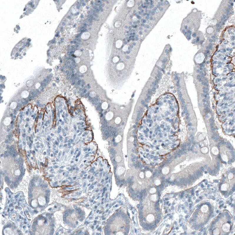 Integrin beta 4/CD104 Antibody (CL6972) - Azide and BSA Free Immunohistochemistry-Paraffin: Integrin beta 4/CD104 Antibody [NBP3-44419]