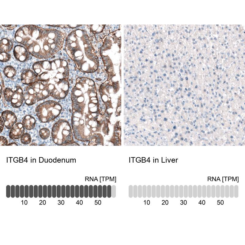 Integrin beta 4/CD104 Antibody (CL6973) - Azide and BSA Free Immunohistochemistry-Paraffin: Integrin beta 4/CD104 Antibody [NBP3-44420]