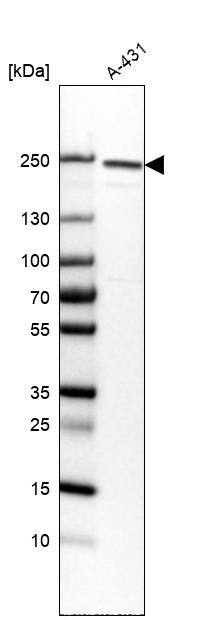 Integrin beta 4/CD104 Antibody (CL6973) - Azide and BSA Free Western Blot: Integrin beta 4/CD104 Antibody [NBP3-44420]