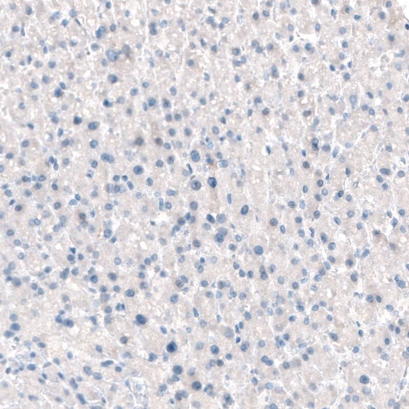 Integrin beta 4/CD104 Antibody (CL6973) - Azide and BSA Free Immunohistochemistry-Paraffin: Integrin beta 4/CD104 Antibody [NBP3-44420]