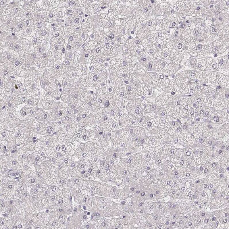 LAMC2 Antibody (CL2980) - Azide and BSA Free Immunohistochemistry-Paraffin: LAMC2 Antibody [NBP3-44421]