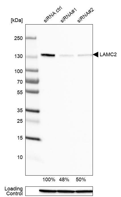 LAMC2 Antibody (CL2980) - Azide and BSA Free Western Blot: LAMC2 Antibody [NBP3-44421]
