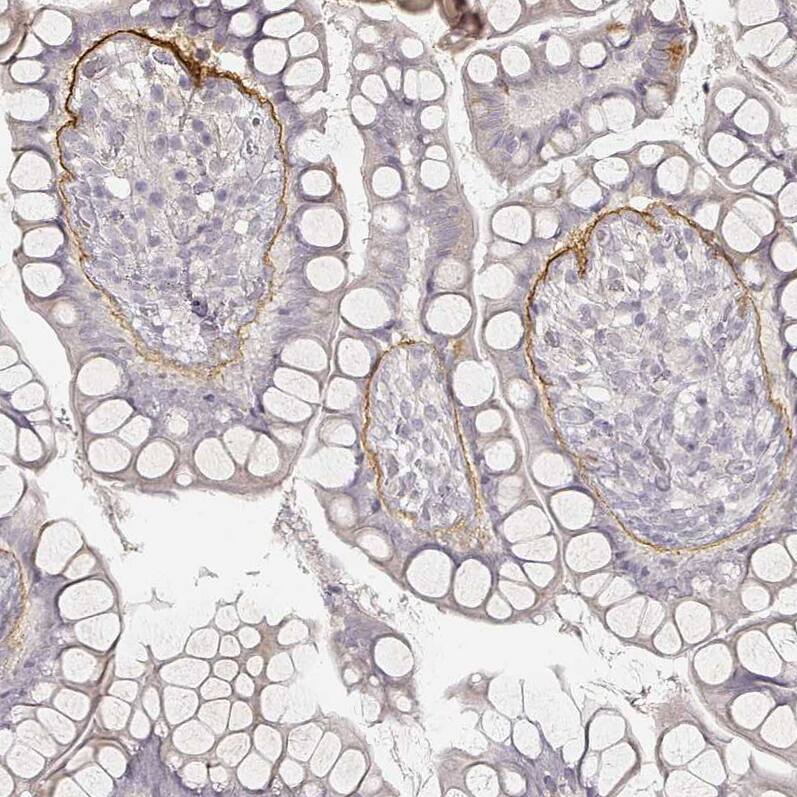 LAMC2 Antibody (CL2980) - Azide and BSA Free Immunohistochemistry-Paraffin: LAMC2 Antibody [NBP3-44421]
