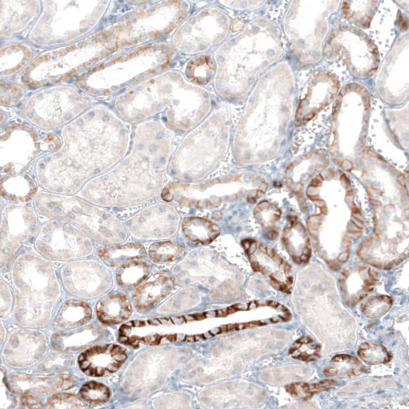EpCAM/TROP1 Antibody (CL6259) - Azide and BSA Free Immunohistochemistry-Paraffin: EpCAM/TROP1 Antibody [NBP3-44422]