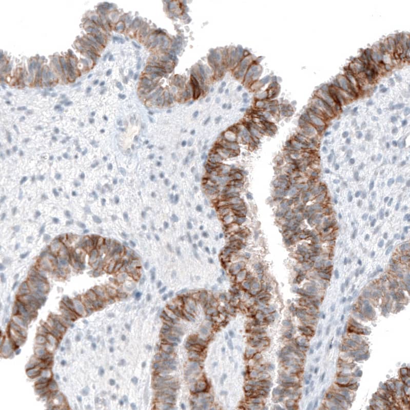 EpCAM/TROP1 Antibody (CL6259) - Azide and BSA Free Immunohistochemistry-Paraffin: EpCAM/TROP1 Antibody [NBP3-44422]