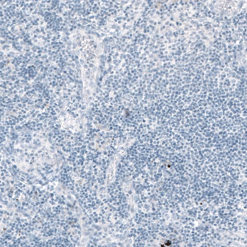 EpCAM/TROP1 Antibody (CL6259) - Azide and BSA Free Immunohistochemistry-Paraffin: EpCAM/TROP1 Antibody [NBP3-44422]