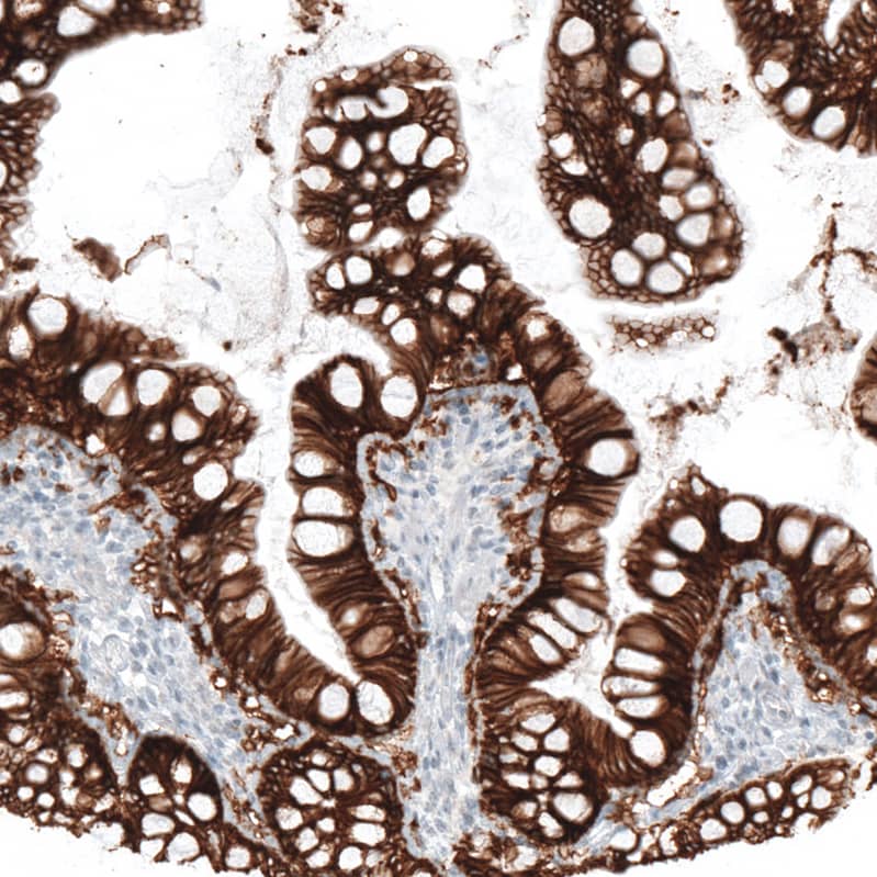 EpCAM/TROP1 Antibody (CL6259) - Azide and BSA Free Immunohistochemistry-Paraffin: EpCAM/TROP1 Antibody [NBP3-44422]