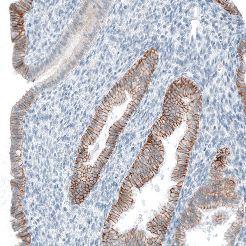 EpCAM/TROP1 Antibody (CL6313) - Azide and BSA Free Immunohistochemistry-Paraffin: EpCAM/TROP1 Antibody [NBP3-44423]