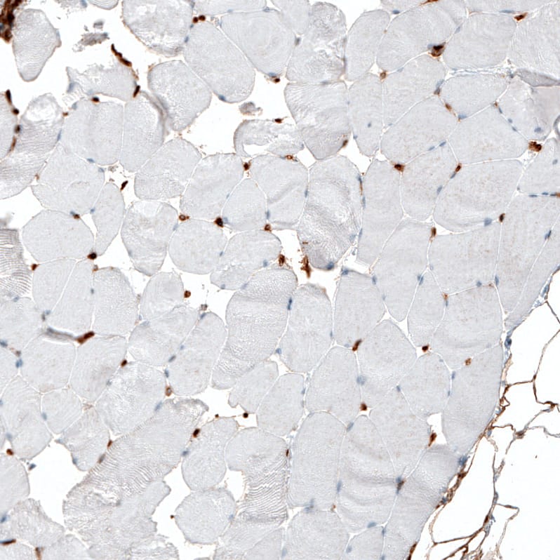 Integrin alpha 1/CD49a Antibody (CL7207) - Azide and BSA Free Immunohistochemistry-Paraffin: Integrin alpha 1/CD49a Antibody [NBP3-44430]