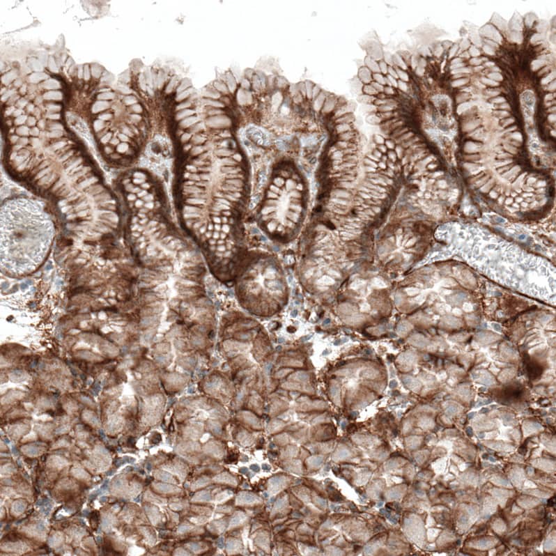 Integrin alpha 1/CD49a Antibody (CL7207) - Azide and BSA Free Immunohistochemistry-Paraffin: Integrin alpha 1/CD49a Antibody [NBP3-44430]