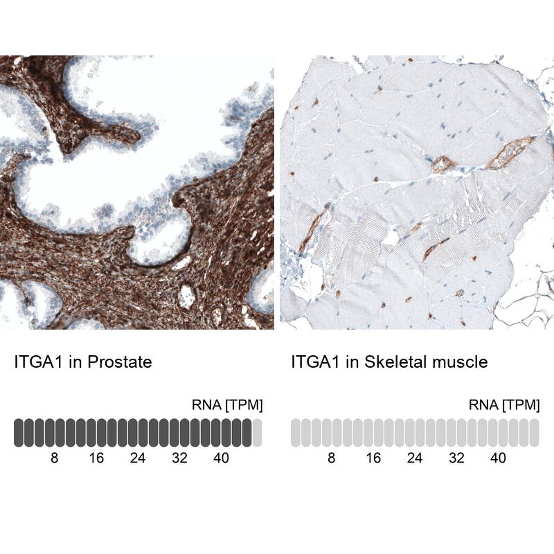 Integrin alpha 1/CD49a Antibody (CL7217) - Azide and BSA Free Immunohistochemistry-Paraffin: Integrin alpha 1/CD49a Antibody [NBP3-44431]
