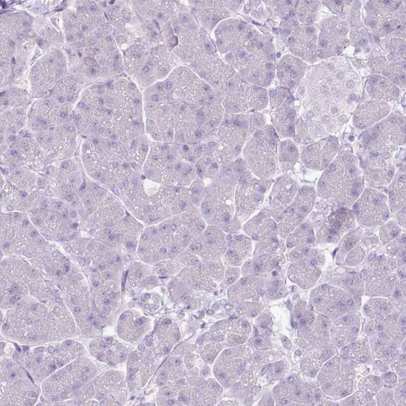 FATP5/SLC27A5 Antibody (CL0213) - Azide and BSA Free Immunohistochemistry-Paraffin: FATP5/SLC27A5 Antibody [NBP3-44432]
