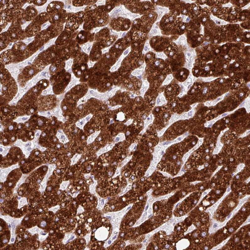 FATP5/SLC27A5 Antibody (CL0213) - Azide and BSA Free Immunohistochemistry-Paraffin: FATP5/SLC27A5 Antibody [NBP3-44432]