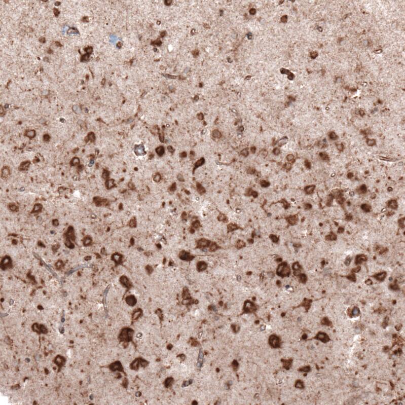 gp96/HSP90B1/GRP94 Antibody (CL2647) - Azide and BSA Free Immunohistochemistry-Paraffin: gp96/HSP90B1/GRP94 Antibody [NBP3-44433]