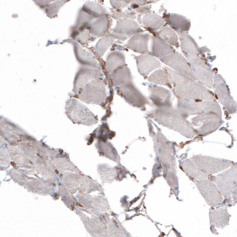 gp96/HSP90B1/GRP94 Antibody (CL2647) - Azide and BSA Free Immunohistochemistry-Paraffin: gp96/HSP90B1/GRP94 Antibody [NBP3-44433]