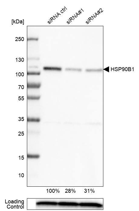 gp96/HSP90B1/GRP94 Antibody (CL2647) - Azide and BSA Free Western Blot: gp96/HSP90B1/GRP94 Antibody [NBP3-44433]
