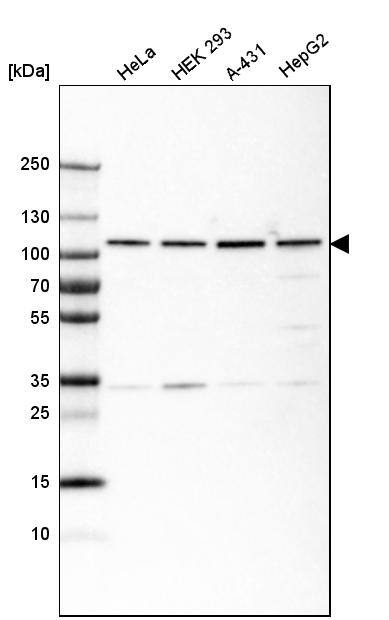 gp96/HSP90B1/GRP94 Antibody (CL2647) - Azide and BSA Free Western Blot: gp96/HSP90B1/GRP94 Antibody [NBP3-44433]