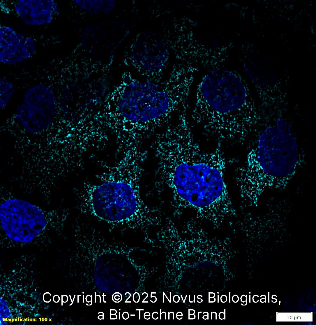 gp96/HSP90B1/GRP94 Antibody (CL2647) [Alexa Fluor® 647]