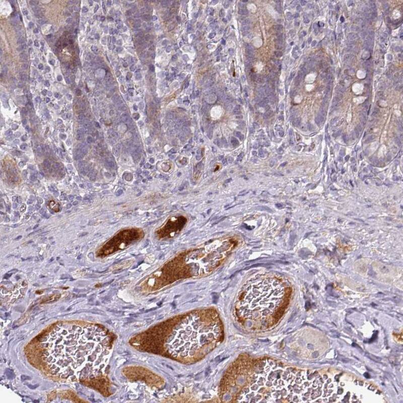 Apolipoprotein L1 Antibody (CL0171) - Azide and BSA Free Immunohistochemistry-Paraffin: Apolipoprotein L1 Antibody [NBP3-44434]