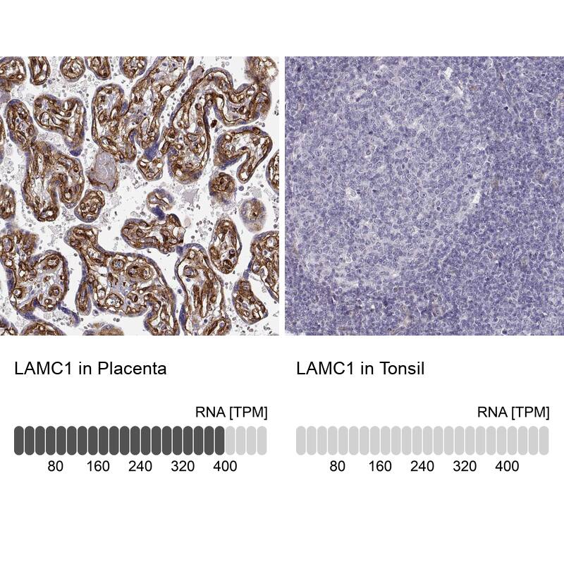 Laminin gamma 1 Antibody (CL3199) - Azide and BSA Free Immunohistochemistry-Paraffin: Laminin gamma 1 Antibody [NBP3-44435]