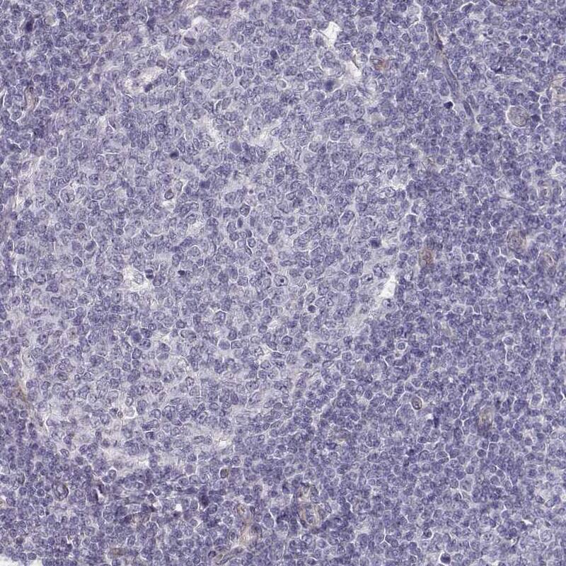 Laminin gamma 1 Antibody (CL3199) - Azide and BSA Free Immunohistochemistry-Paraffin: Laminin gamma 1 Antibody [NBP3-44435]