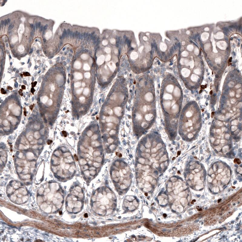 Laminin gamma 1 Antibody (CL3199) - Azide and BSA Free Immunohistochemistry-Paraffin: Laminin gamma 1 Antibody [NBP3-44435]