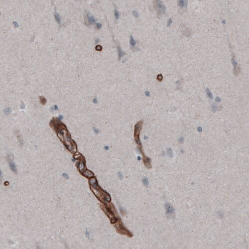 Laminin gamma 1 Antibody (CL3201) - Azide and BSA Free Immunohistochemistry-Paraffin: Laminin gamma 1 Antibody [NBP3-44436]