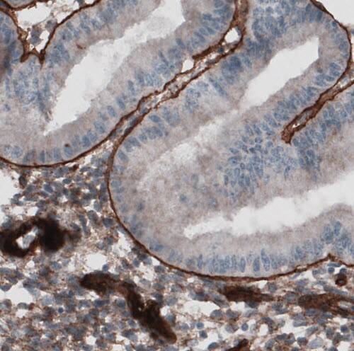 Laminin gamma 1 Antibody (CL3201) - Azide and BSA Free Immunohistochemistry-Paraffin: Laminin gamma 1 Antibody [NBP3-44436]