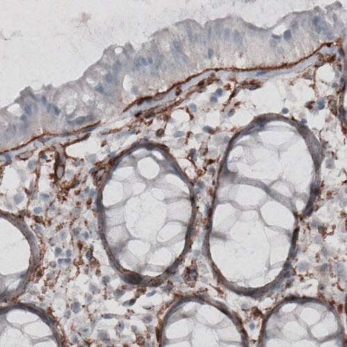 Laminin gamma 1 Antibody (CL3201) - Azide and BSA Free Immunohistochemistry-Paraffin: Laminin gamma 1 Antibody [NBP3-44436]