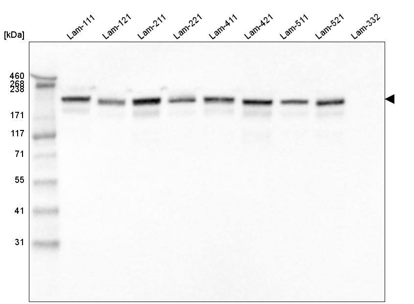 Laminin gamma 1 Antibody (CL3201) - Azide and BSA Free Western Blot: Laminin gamma 1 Antibody [NBP3-44436]