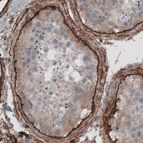 Laminin gamma 1 Antibody (CL3201) - Azide and BSA Free Immunohistochemistry-Paraffin: Laminin gamma 1 Antibody [NBP3-44436]