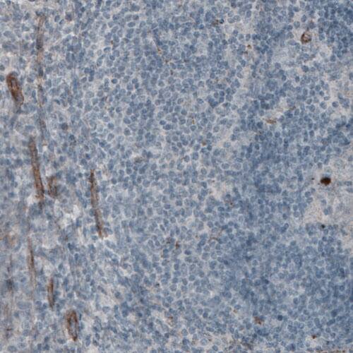 Laminin gamma 1 Antibody (CL3201) - Azide and BSA Free Immunohistochemistry-Paraffin: Laminin gamma 1 Antibody [NBP3-44436]