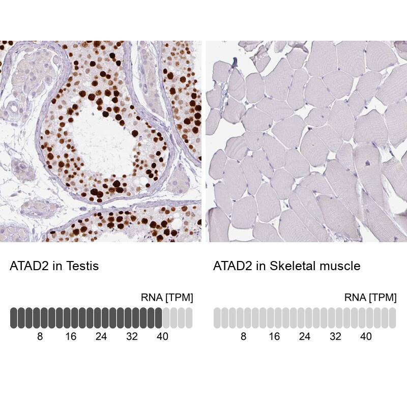 ATAD2 Antibody (CL0182) - Azide and BSA Free Immunohistochemistry-Paraffin: ATAD2 Antibody [NBP3-44437]