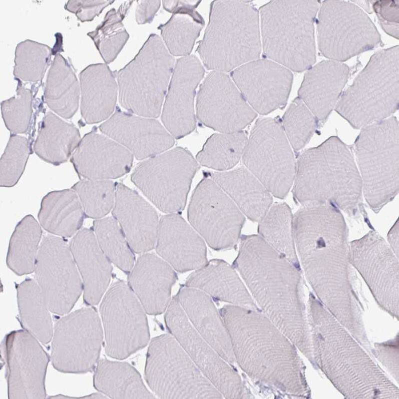 ATAD2 Antibody (CL0182) - Azide and BSA Free Immunohistochemistry-Paraffin: ATAD2 Antibody [NBP3-44437]