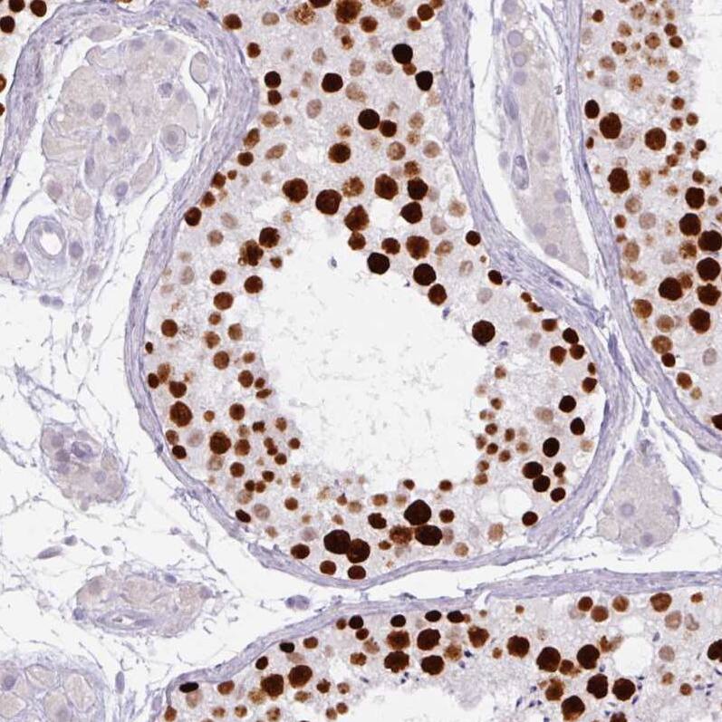 ATAD2 Antibody (CL0182) - Azide and BSA Free Immunohistochemistry-Paraffin: ATAD2 Antibody [NBP3-44437]