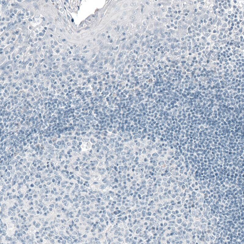 Prolactin Antibody (CL6550) - Azide and BSA Free Immunohistochemistry-Paraffin: Prolactin Antibody [NBP3-44438]