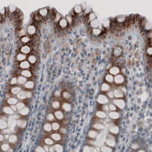 ACAA1 Antibody (CL2650) - Azide and BSA Free Immunohistochemistry-Paraffin: ACAA1 Antibody [NBP3-44444]