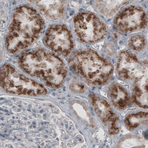 ACAA1 Antibody (CL2650) - Azide and BSA Free Immunohistochemistry-Paraffin: ACAA1 Antibody [NBP3-44444]