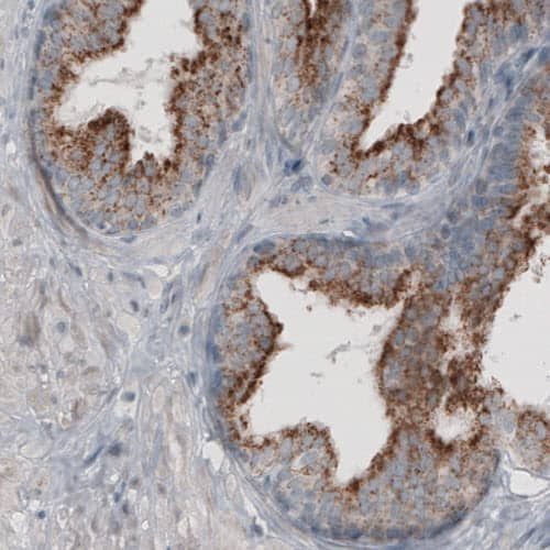 ACAA1 Antibody (CL2650) - Azide and BSA Free Immunohistochemistry-Paraffin: ACAA1 Antibody [NBP3-44444]